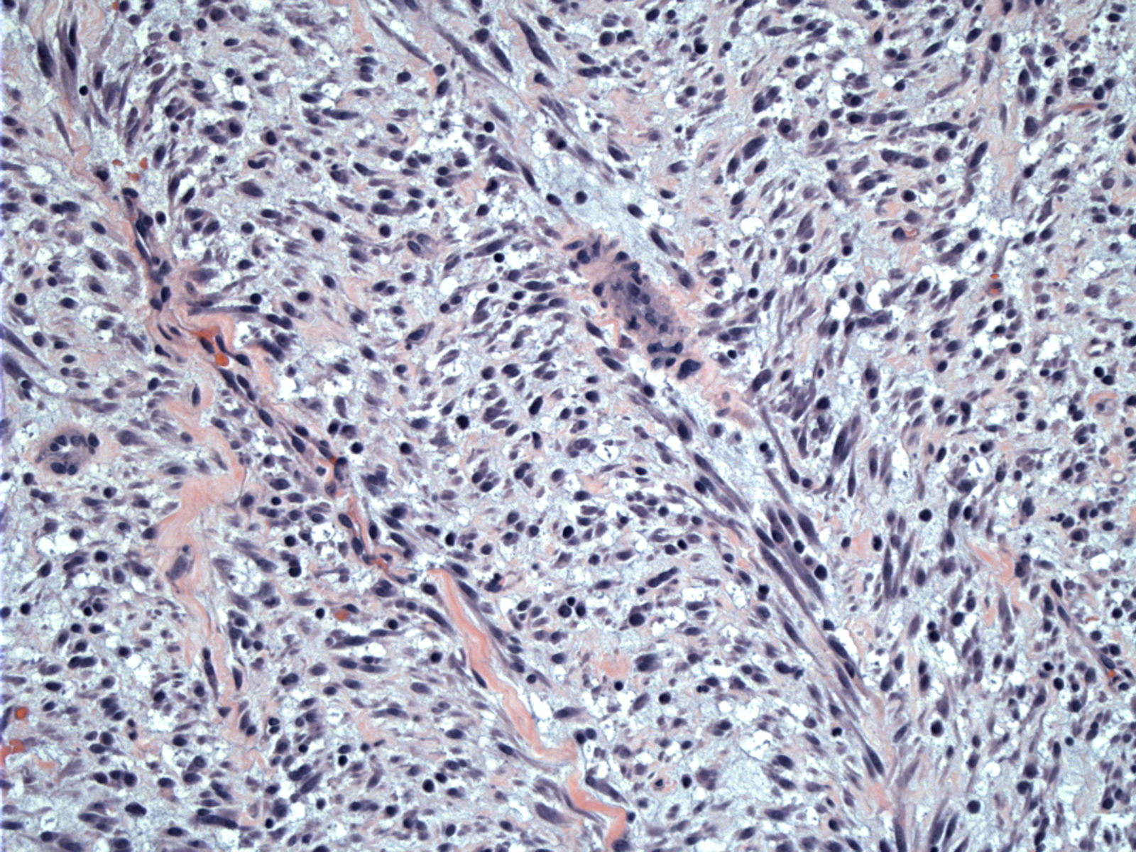 Pathology Image